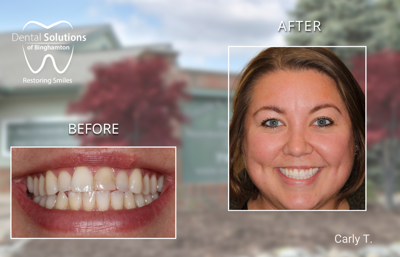 Cosmetic Transformation