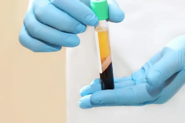 Platelet-Rich Plasma pic