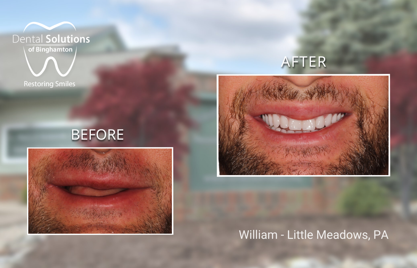 William - Little Meadows, PA